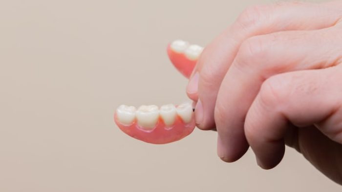 Harga pasang gigi palsu.| Unsplash.com