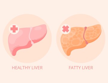 Gambar dalam artikel Materi IPA Organ-Organ Sistem Ekskresi (2/3). hargabelanja.com